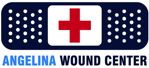 Angelina Wound Center Lgo