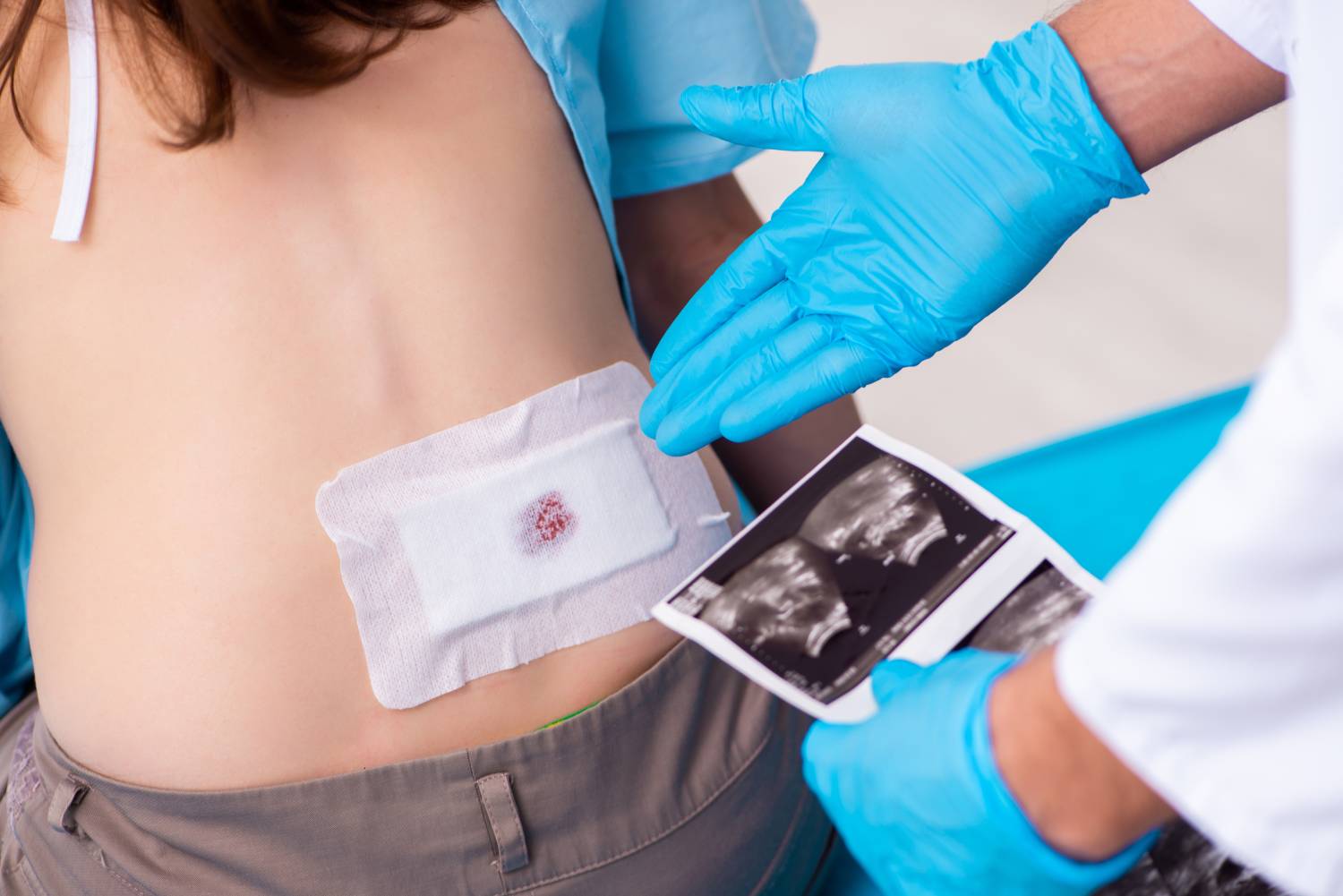 Arobella® Ultrasound Wound Therapy